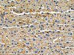 ATP5S Antibody in Immunohistochemistry (Paraffin) (IHC (P))