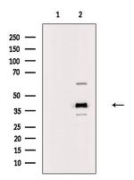 B4GALT5 Antibody in Western Blot (WB)