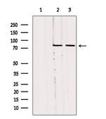 SLC27A5 Antibody in Western Blot (WB)