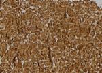 BRWD3 Antibody in Immunohistochemistry (Paraffin) (IHC (P))