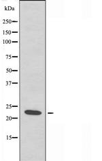CHP2 Antibody in Western Blot (WB)