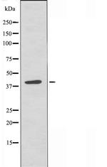 CHST8 Antibody in Western Blot (WB)