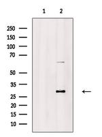 Carbonic Anhydrase I Antibody in Western Blot (WB)