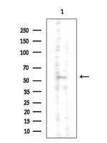 CNOT4 Antibody in Western Blot (WB)