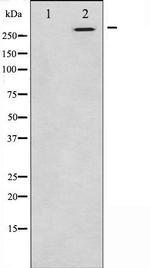 CEP290 Antibody in Western Blot (WB)