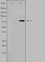 CNGA1 Antibody in Western Blot (WB)