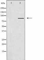 CLCN7 Antibody in Western Blot (WB)