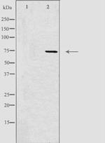 CLIC6 Antibody in Western Blot (WB)