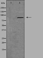 CSGLCAT Antibody in Western Blot (WB)