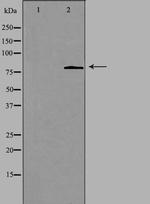 CHPF Antibody in Western Blot (WB)