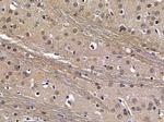 CSTF2T Antibody in Immunohistochemistry (Paraffin) (IHC (P))