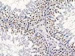 CSTF2T Antibody in Immunohistochemistry (Paraffin) (IHC (P))