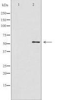 GBA3 Antibody in Western Blot (WB)