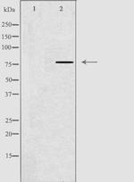 GNPAT Antibody in Western Blot (WB)