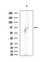 GNPAT Antibody in Western Blot (WB)