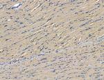 DZIP3 Antibody in Immunohistochemistry (Paraffin) (IHC (P))