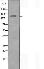 DZIP3 Antibody in Western Blot (WB)