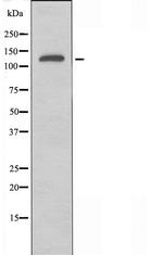 NEDL2 Antibody in Western Blot (WB)