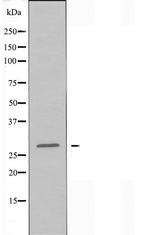 RNF138 Antibody in Western Blot (WB)