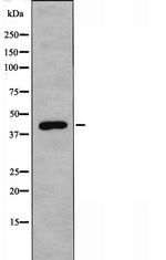 NEIL1 Antibody in Western Blot (WB)