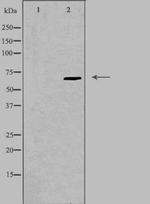 Epsin 2 Antibody in Western Blot (WB)