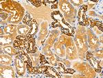 Folate Receptor alpha Antibody in Immunohistochemistry (Paraffin) (IHC (P))