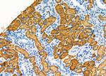 Aldolase B Antibody in Immunohistochemistry (Paraffin) (IHC (P))