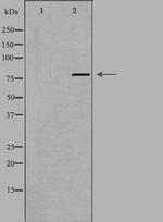 C2orf3 Antibody in Western Blot (WB)