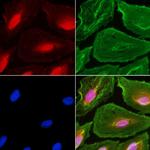 C2orf3 Antibody in Immunocytochemistry (ICC/IF)