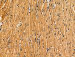 SAR1B Antibody in Immunohistochemistry (Paraffin) (IHC (P))