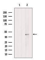 HOXA5 Antibody in Western Blot (WB)