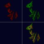 SIX5 Antibody in Immunocytochemistry (ICC/IF)