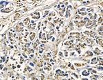 AASDHPPT Antibody in Immunohistochemistry (Paraffin) (IHC (P))