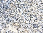 AASDHPPT Antibody in Immunohistochemistry (Paraffin) (IHC (P))