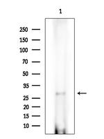 AASDHPPT Antibody in Western Blot (WB)