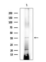 AASDHPPT Antibody in Western Blot (WB)