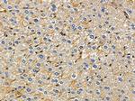 LDLRAD1 Antibody in Immunohistochemistry (Paraffin) (IHC (P))