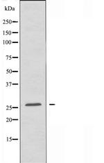 LDLRAD1 Antibody in Western Blot (WB)