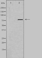 LRP3 Antibody in Western Blot (WB)