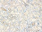 SLC25A21 Antibody in Immunohistochemistry (Paraffin) (IHC (P))