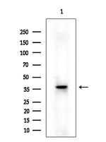 SLC25A21 Antibody in Western Blot (WB)