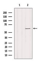 SLC16A2 Antibody in Western Blot (WB)
