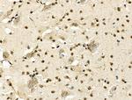 MDFI Antibody in Immunohistochemistry (Paraffin) (IHC (P))