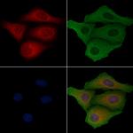 NDUFA9 Antibody in Immunocytochemistry (ICC/IF)