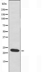 NDUFB10 Antibody in Western Blot (WB)