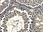 PTGR1 Antibody in Immunohistochemistry (Paraffin) (IHC (P))