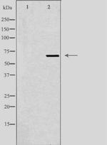 ME3 Antibody in Western Blot (WB)