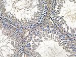 NPDC1 Antibody in Immunohistochemistry (Paraffin) (IHC (P))