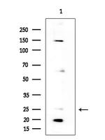 NPDC1 Antibody in Western Blot (WB)