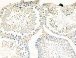 SLC15A1 Antibody in Immunohistochemistry (Paraffin) (IHC (P))